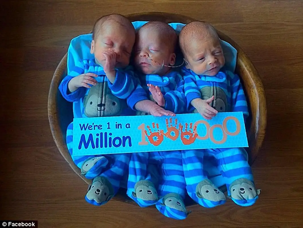 Uno en un millon: Tres Gemelos identicos