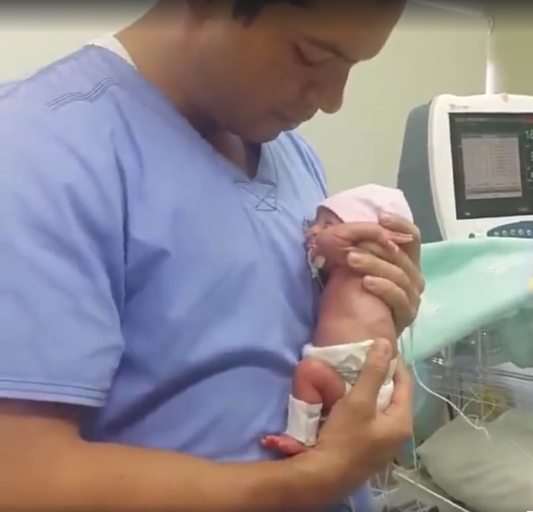 Pediatra mima a bebé prematuro