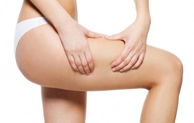 piernas de mujer piernas con estrias