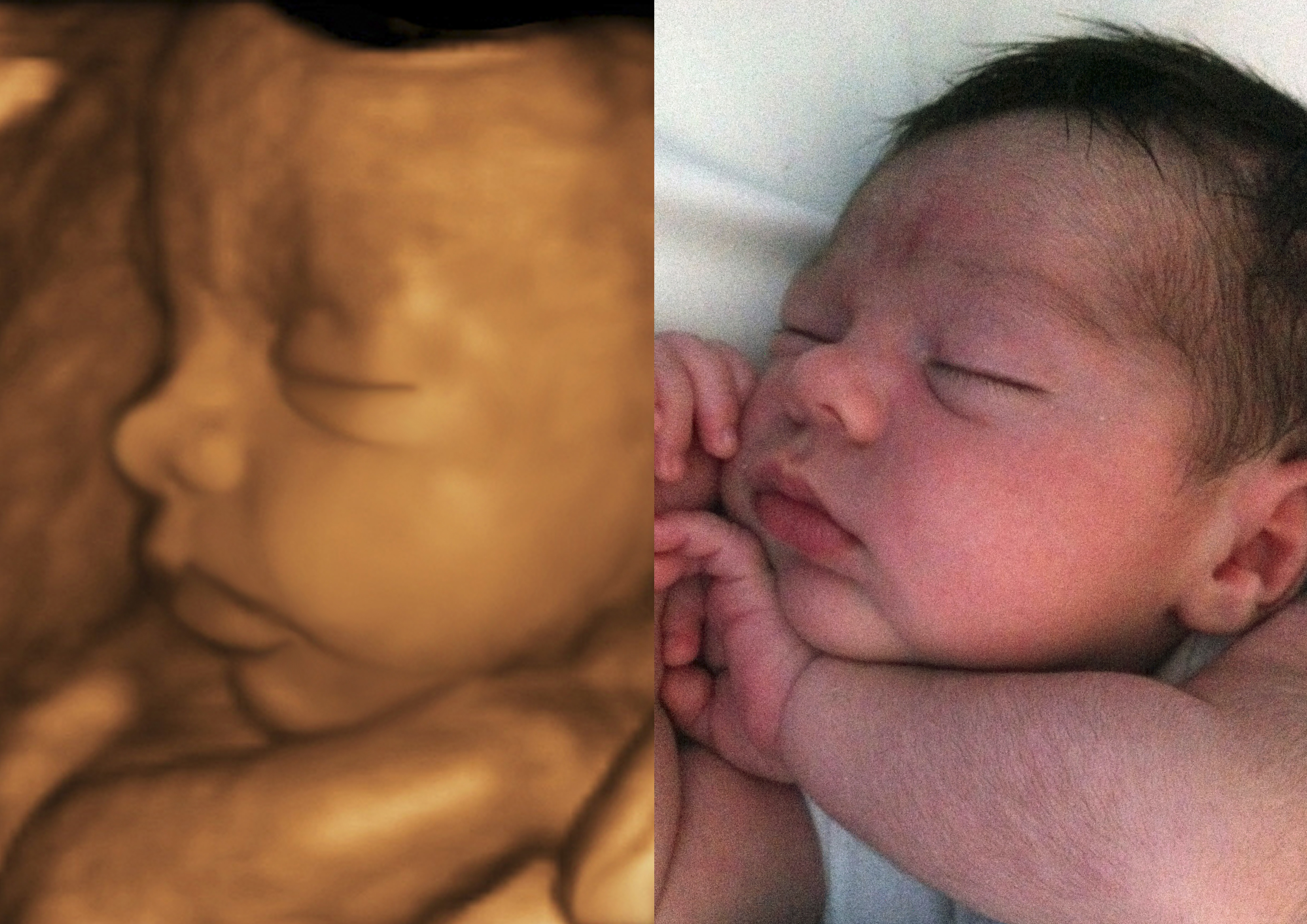 Comparativa ecografía 4D y bebé recién nacido