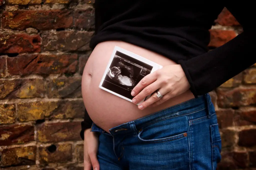 etapa prenatal etapa prenatal