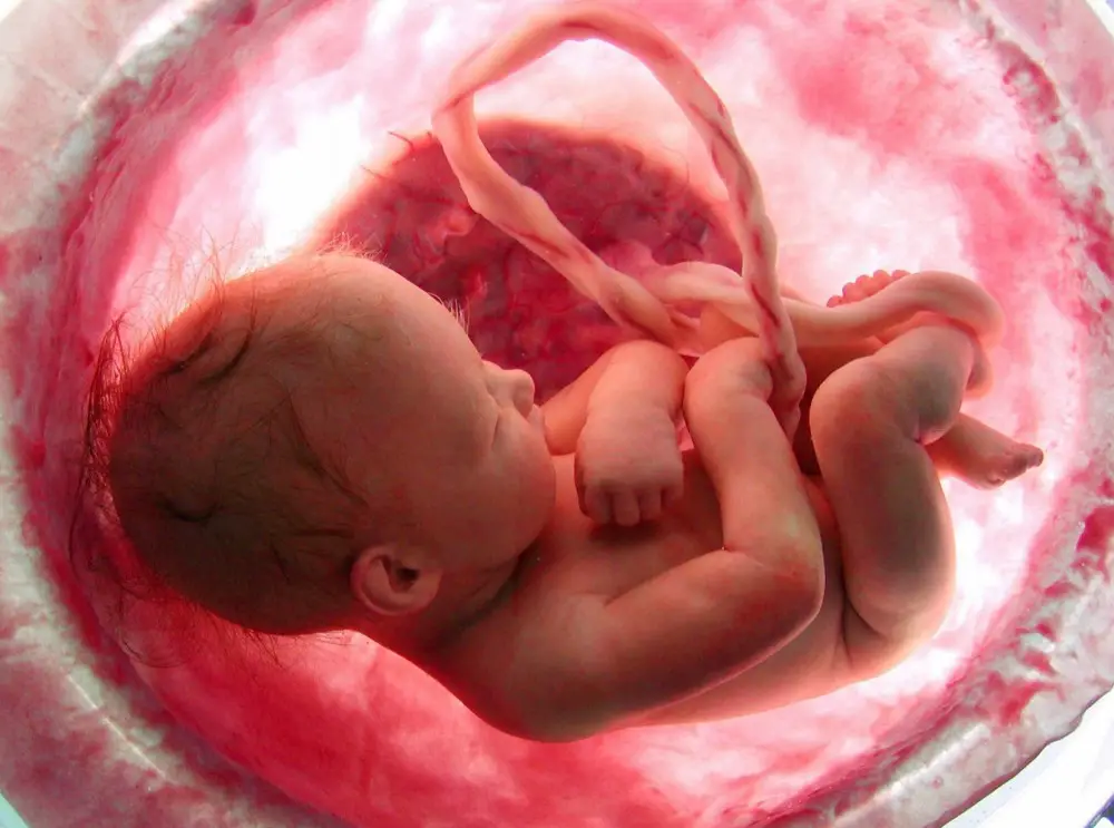 placenta y bebe