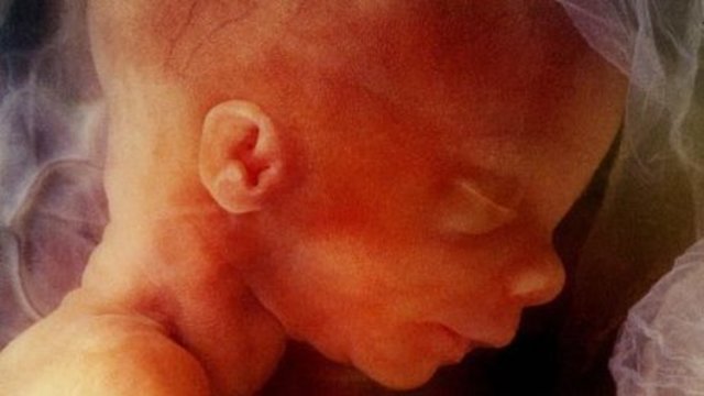 imágenes de embarazo imágenes del embarazo feto de 24 semanas