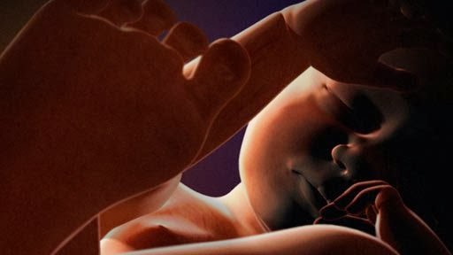 imágenes del embarazo feto de 26 semanas