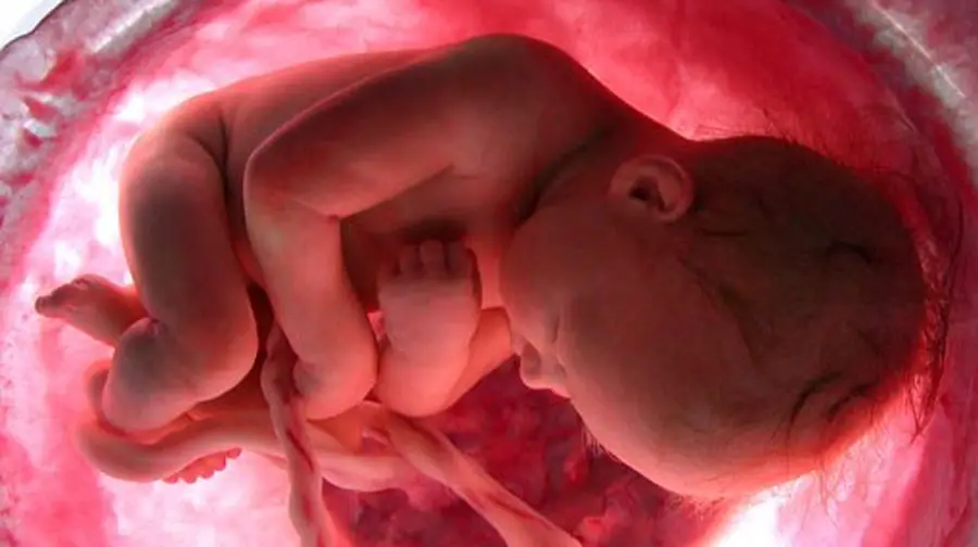 imágenes del embarazo feto de 36 semanas