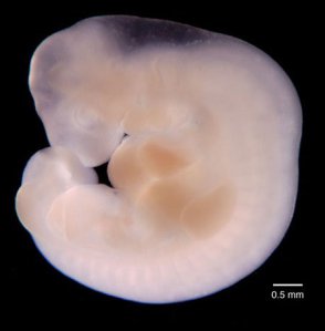 imágenes del embarazo feto de cuatro semanas