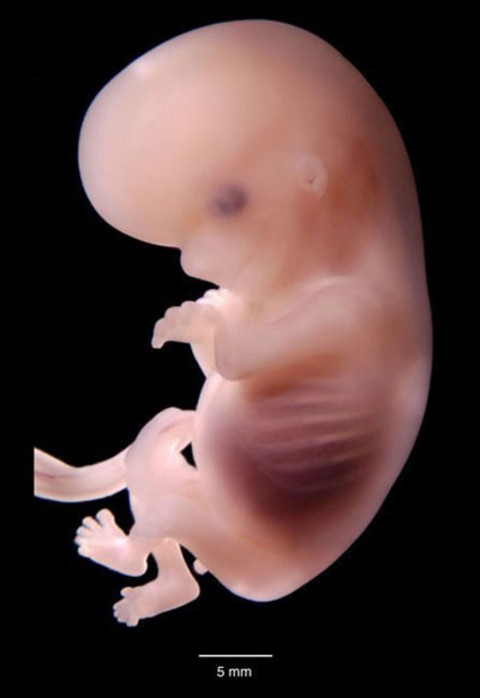 imágenes del embarazo feto de ocho semanas