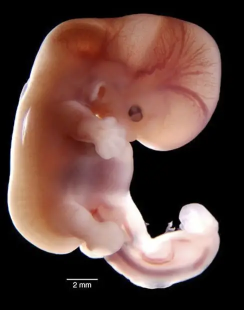 imágenes del embarazo feto de seis semana