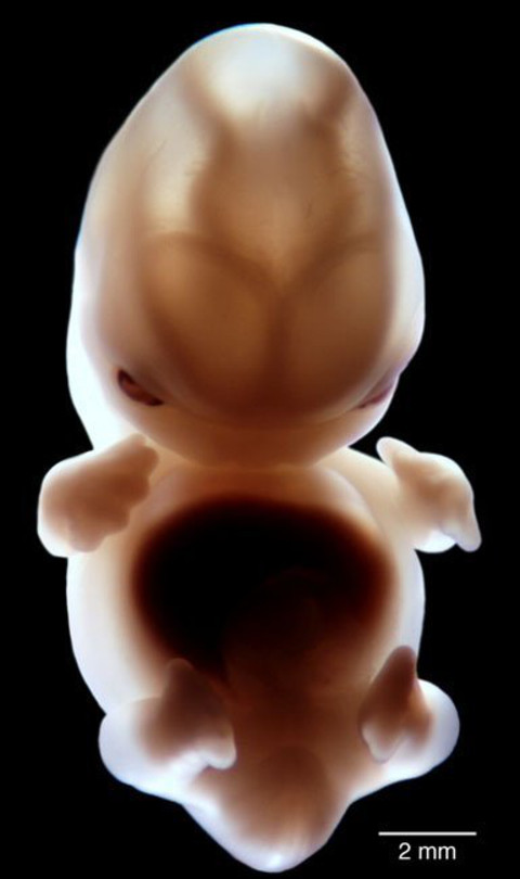 imágenes del embarazo feto de siete semanas