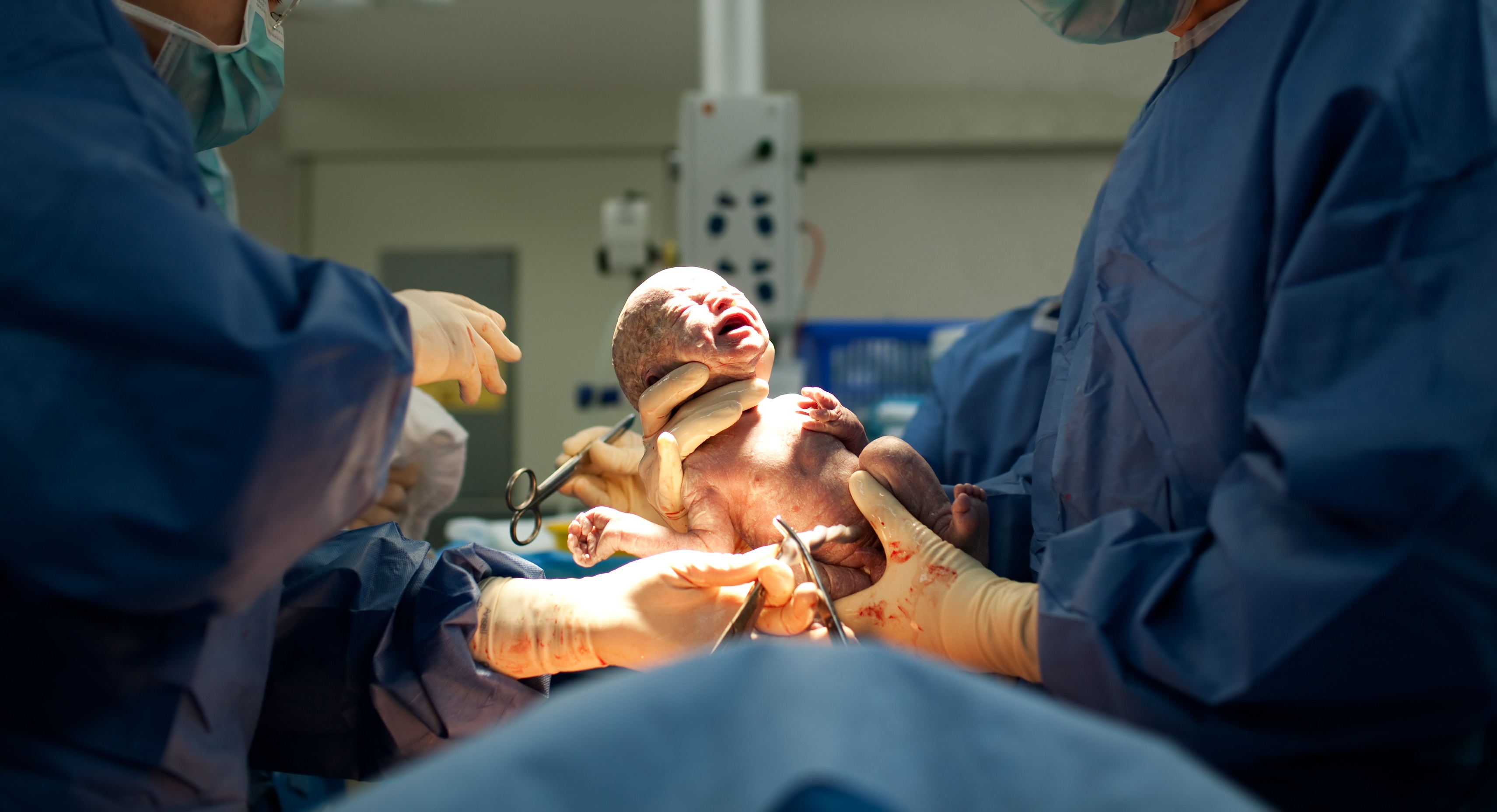 adaptación neonatal Adaptacion neonatal