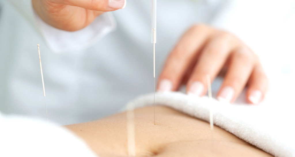acupuntura para adelgazar como acupuntura para adelgazar como