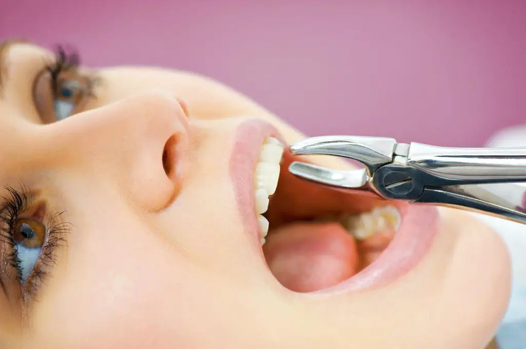 como quitar el dolor de muela dentista