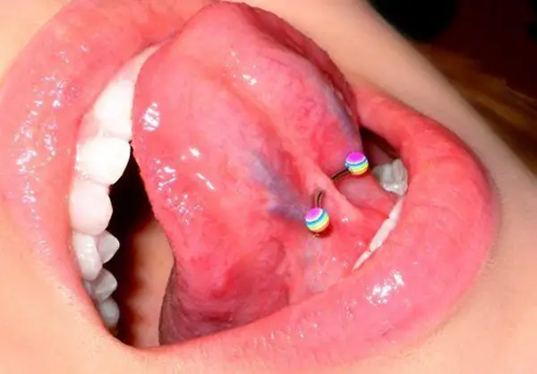 piercing frenillo lengua