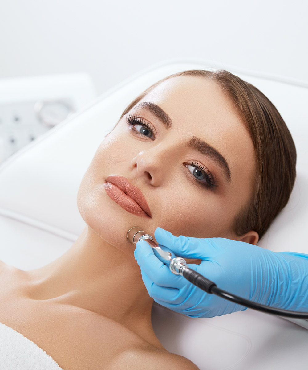 peeling microdermoabrasion