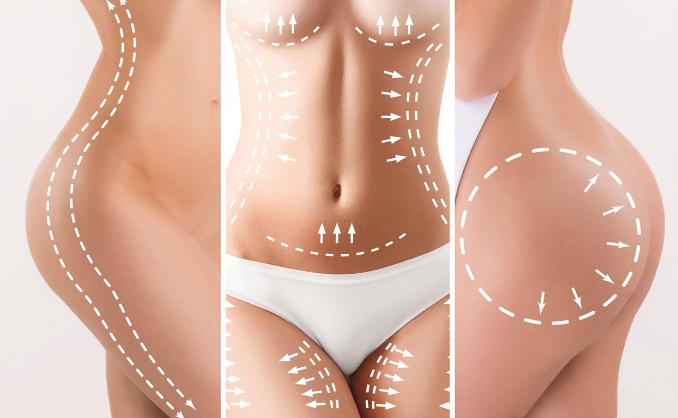 Marcacion abdominal antes y despues mujeres