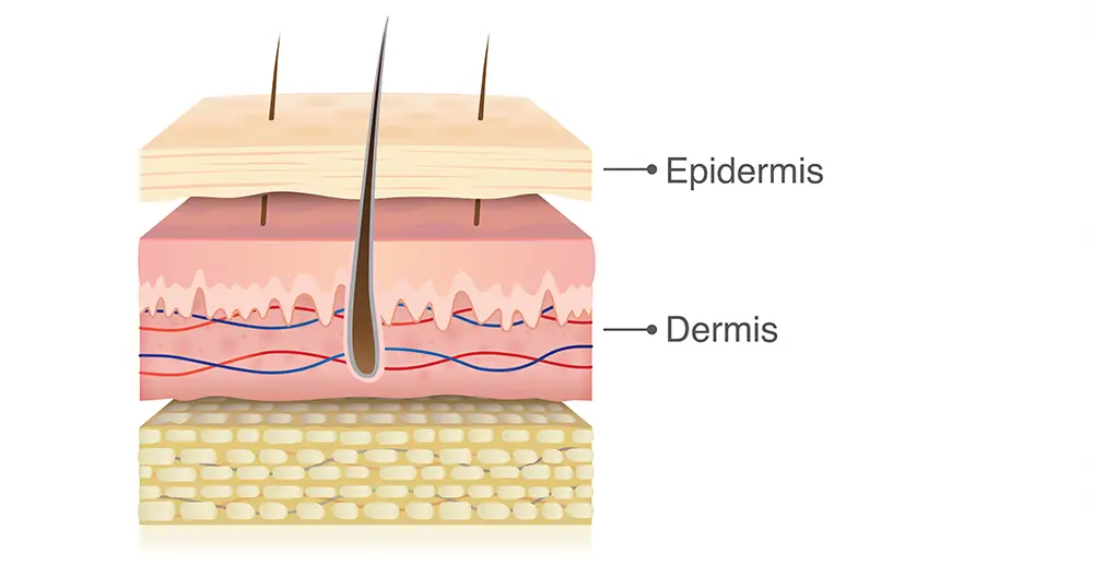 tipos de piel capas tipos de piel capas