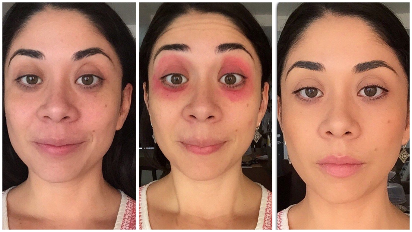 Como maquillar las ojeras