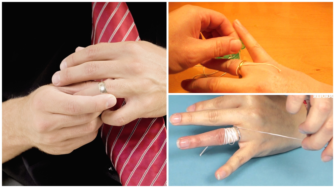 Cómo sacar un anillo del dedo