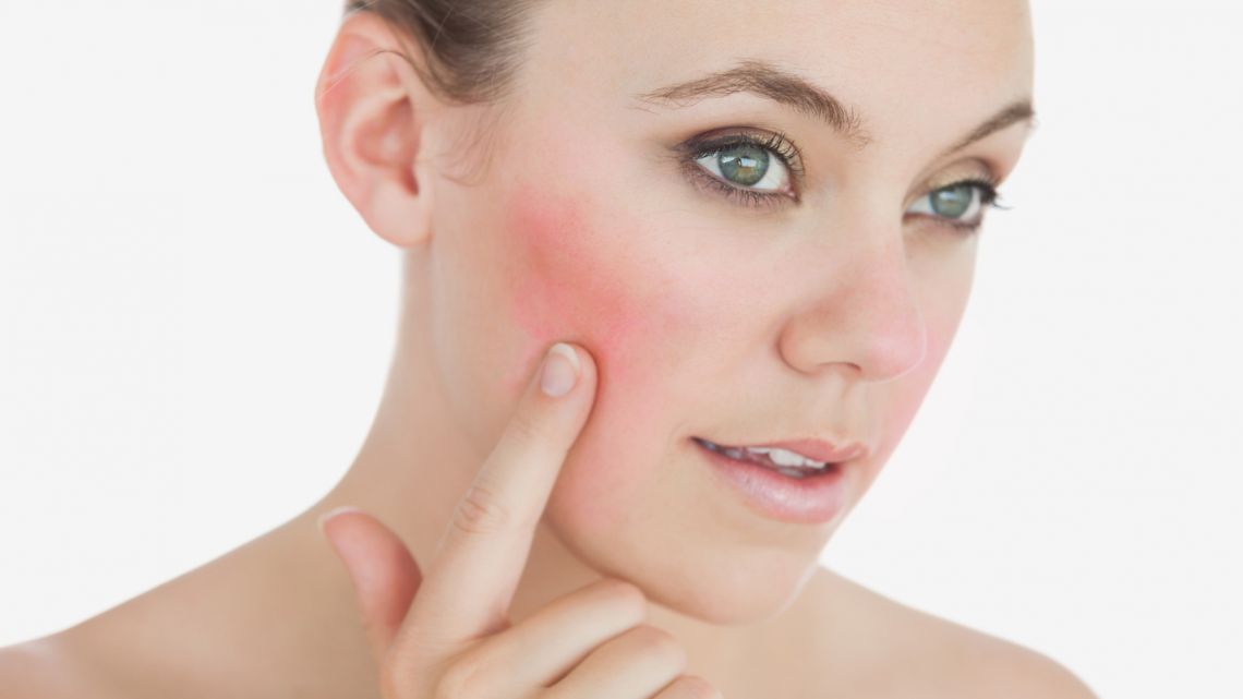 piel rosacea