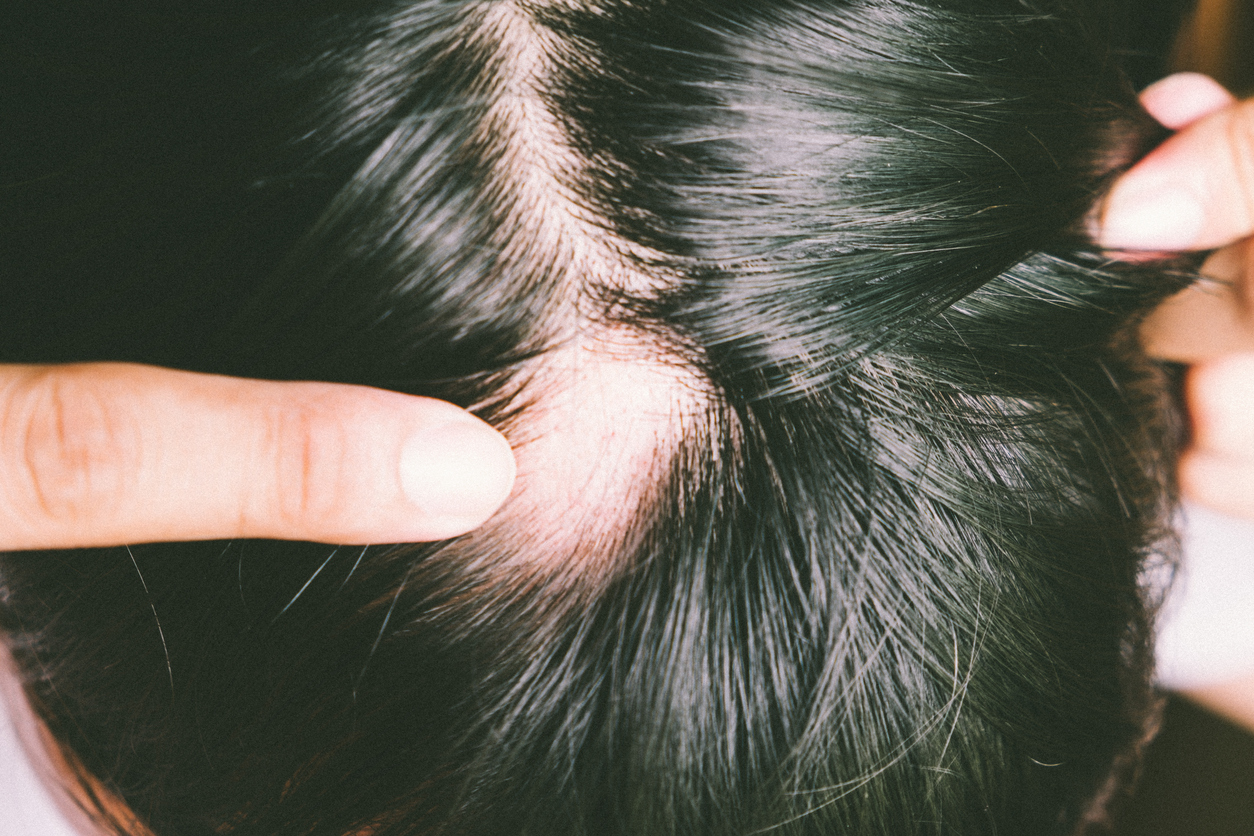 romero para el cabello caida del cabello