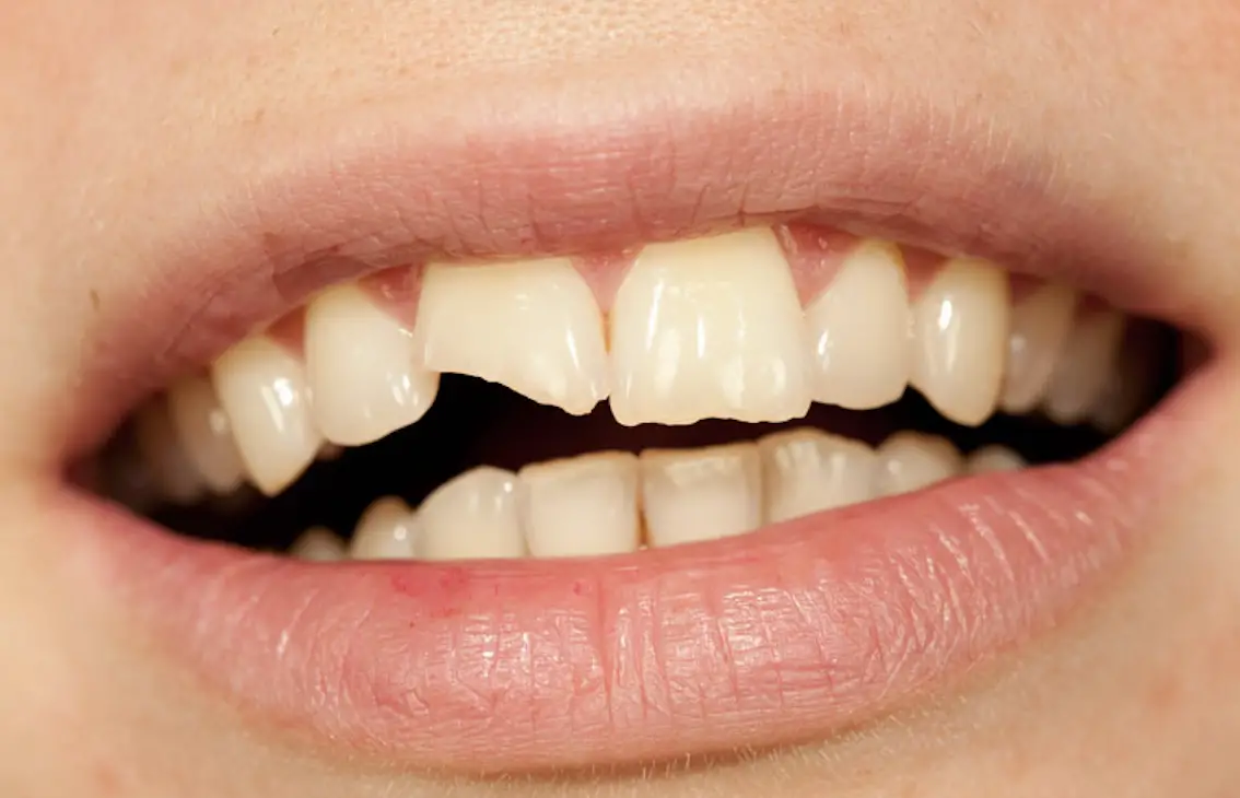 dolor de dientes 5