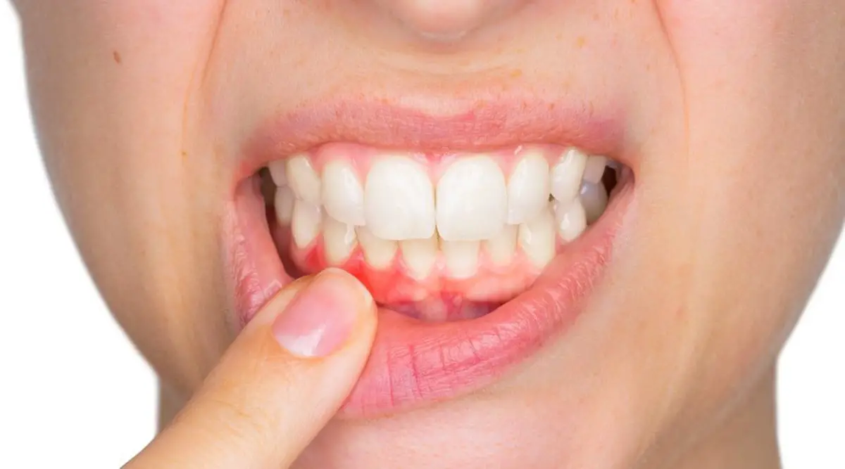 dolor de dientes 7