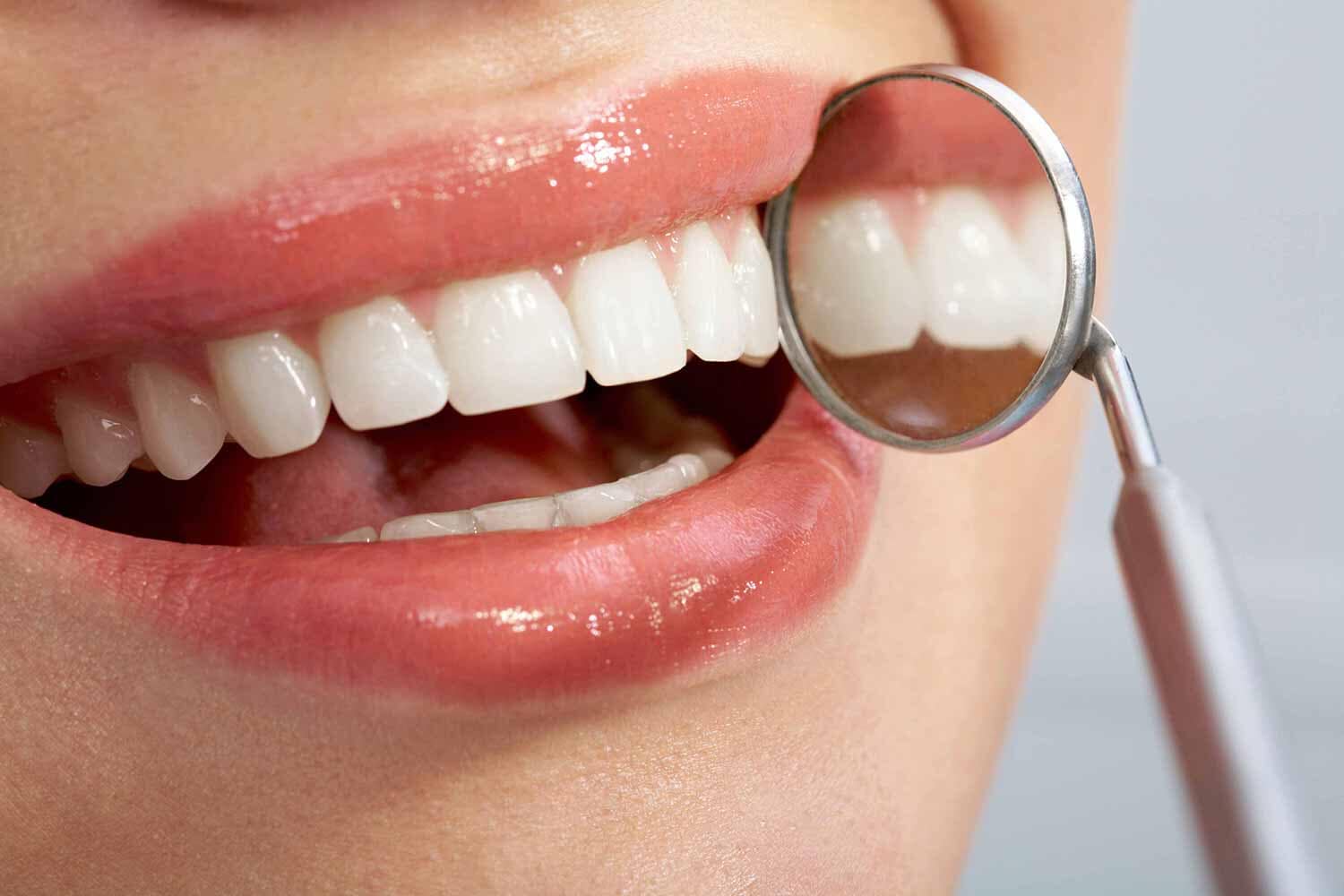 dolor de dientes 8