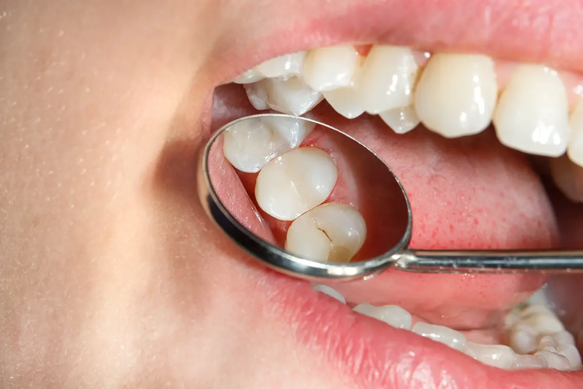 dolor de dientes 9