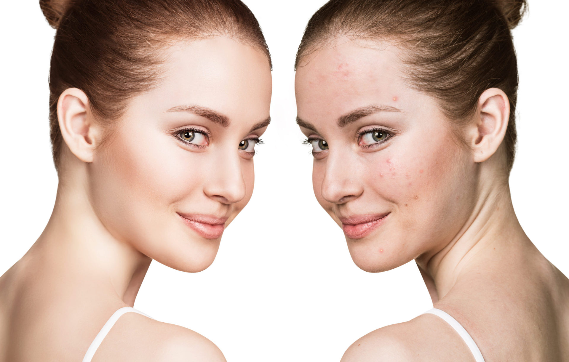 como quitar las manchas de la cara tips
