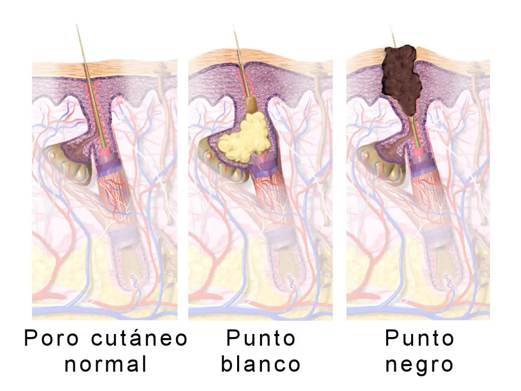 puntos negros